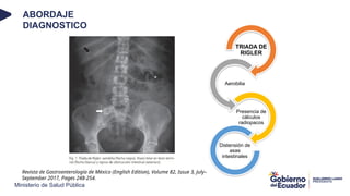Triada Rigeler ILEO BILIAR PRESENTACION DE CASO CLINICO | PPTX