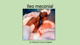 Ileo meconial
Dr. Rolando Cuevas Delgado
 