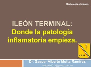ILEÓN TERMINAL:
Donde la patología
inflamatoria empieza.
Radiología e Imagen.
Dr. Gaspar Alberto Motta Ramírez,
radbody2013@yahoo.com.mx
 