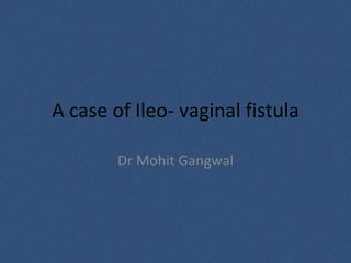 A case of Ileo- vaginal fistula
Dr Mohit Gangwal
 