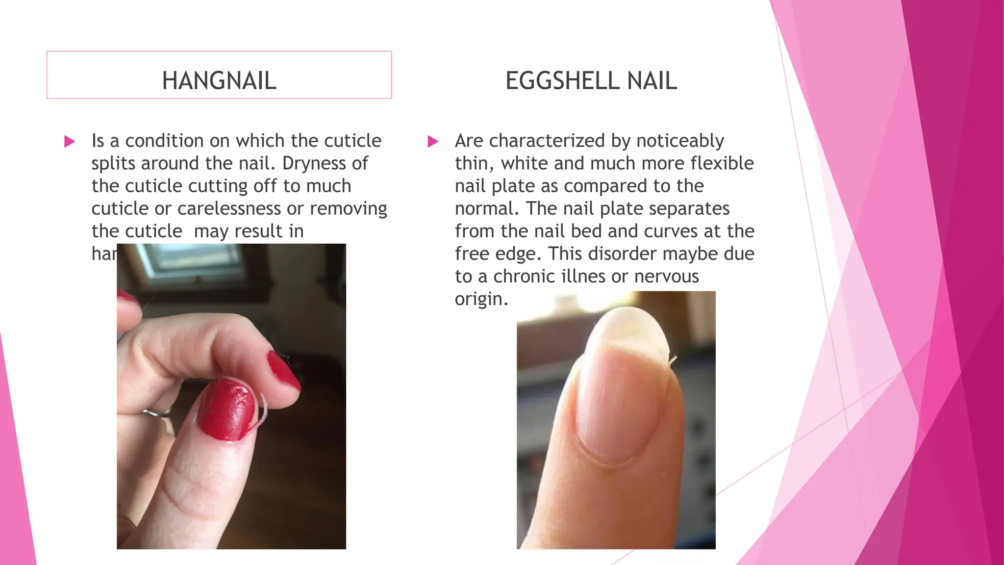 ilide.info-nail-care-pr_be27a1c791358a57202cf2848a0ddfb9.pdf