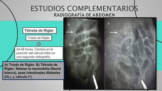 Triada Rigeler ILIEO_BILIAR_EXPO_corregido IX CICLO.pdf