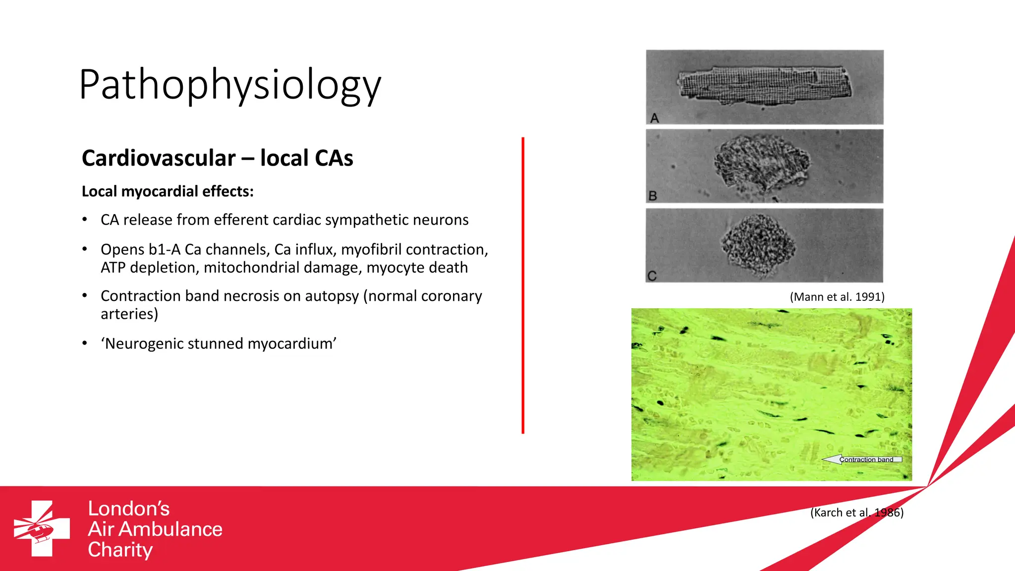 Pathophysiology
Cardiovascular – local CAs
Local myocardial effects:
• CA release from efferent cardiac sympathetic neurons
• Opens b1-A Ca channels, Ca influx, myofibril contraction,
ATP depletion, mitochondrial damage, myocyte death
• Contraction band necrosis on autopsy (normal coronary
arteries)
• ‘Neurogenic stunned myocardium’
(Karch et al. 1986)
(Mann et al. 1991)
 