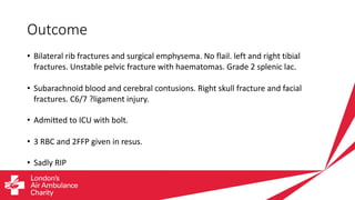 TBI and CV dysfunction - Flora Bird - TBS24 | PDF