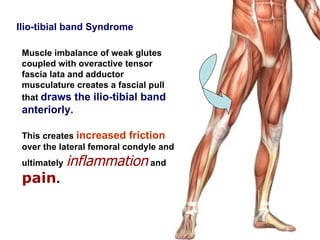 Ilio-tibial band Syndrome

 Muscle imbalance of weak glutes
 coupled with overactive tensor
 fascia lata and adductor
 musculature creates a fascial pull
 that draws the ilio-tibial band
 anteriorly.

 This creates increased friction
 over the lateral femoral condyle and
 ultimately   inflammation and
 pain.
 
