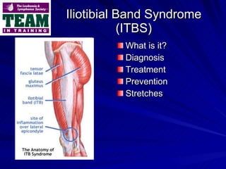 Iliotibial Band Syndrome (ITBS) ,[object Object],[object Object],[object Object],[object Object],[object Object]