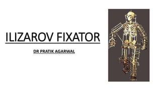 ILIZAROV FIXATOR
DR PRATIK AGARWAL
 
