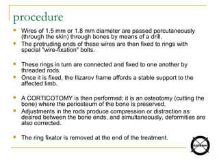 procedure
 Wires of 1.5 mm or 1.8 mm diameter are passed percutaneously
(through the skin) through bones by means of a drill.
 The protruding ends of these wires are then fixed to rings with
special "wire-fixation" bolts.
 These rings in turn are connected and fixed to one another by
threaded rods.
 Once it is fixed, the Ilizarov frame affords a stable support to the
affected limb.
 A CORTICOTOMY is then performed; it is an osteotomy (cutting the
bone) where the periosteum of the bone is preserved.
 Adjustments in the rods produce compression or distraction as
desired between the bone ends, and simultaneously, deformities are
also corrected.
 The ring fixator is removed at the end of the treatment.
 
