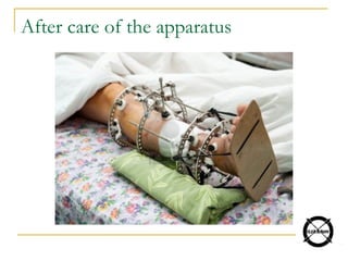 After care of the apparatus
 