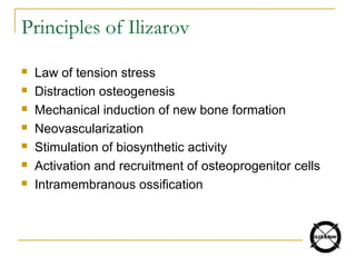 Principles of Ilizarov
 Law of tension stress
 Distraction osteogenesis
 Mechanical induction of new bone formation
 Neovascularization
 Stimulation of biosynthetic activity
 Activation and recruitment of osteoprogenitor cells
 Intramembranous ossification
 