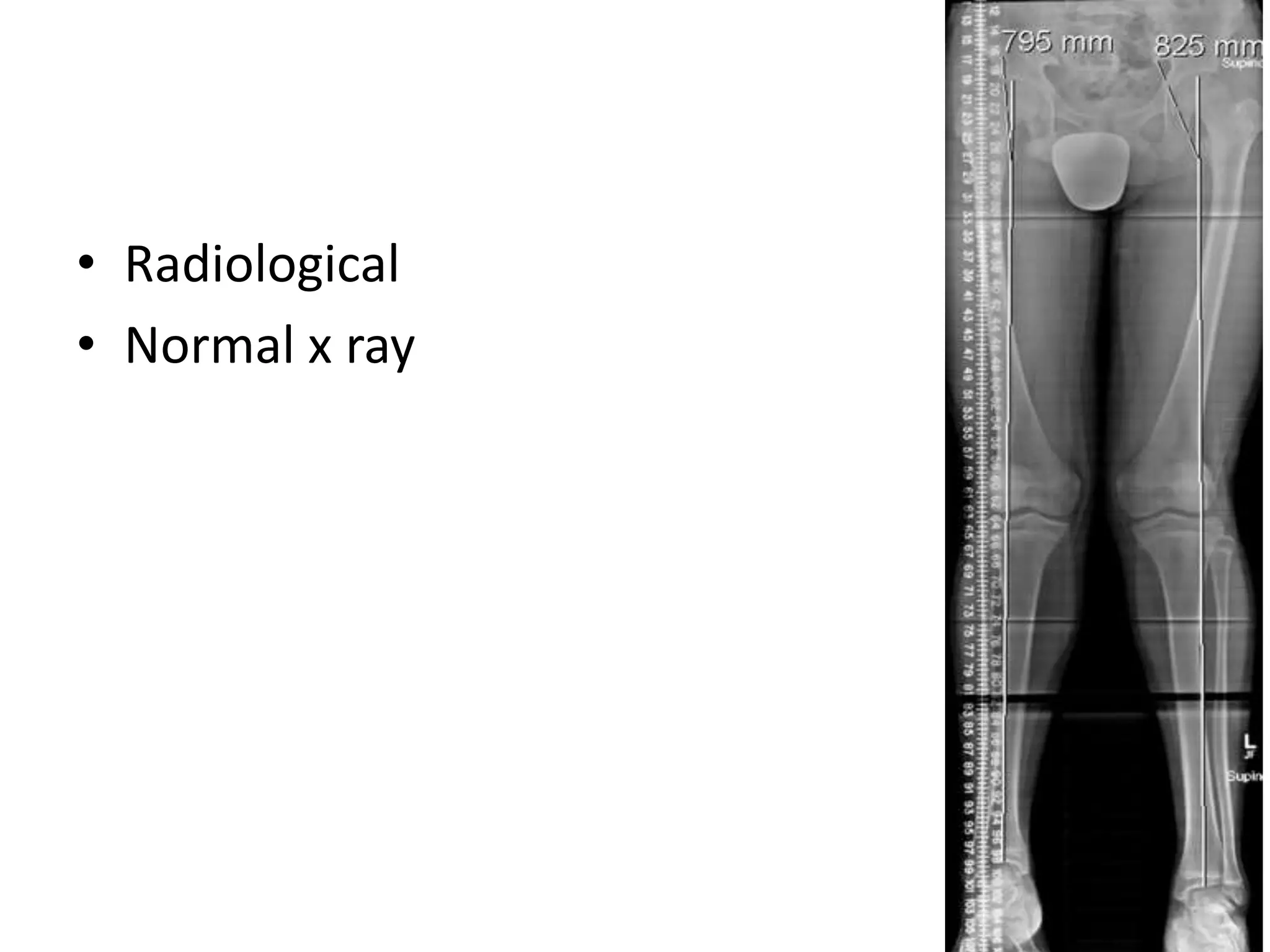 • Radiological
• Normal x ray
 