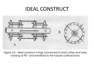IDEAL CONSTRUCT
 
