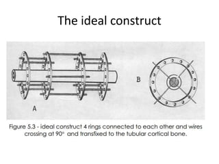 The ideal construct
 