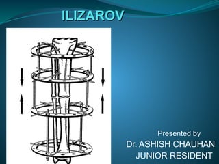 ILIZAROV
ILIZAROV
Presented by
Dr. ASHISH CHAUHAN
JUNIOR RESIDENT
 