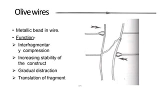 Olivewires
• Metallic bead in wire.
• Function-
 Interfragmentar
y compression
 Increasing stability of
the construct
 Gradual distraction
 Translation of fragment
DPS
 