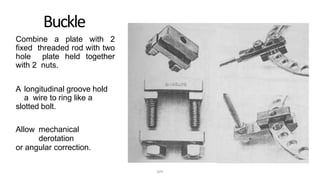Buckle
Combine a plate with 2
fixed threaded rod with two
hole plate held together
with 2 nuts.
A longitudinal groove hold
a wire to ring like a
slotted bolt.
Allow mechanical
derotation
or angular correction.
DPS
 