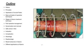 Outline
 History
 Principles
 Application of circular fixator
 Basic principles of operative
techniques
 Stages of Ilizarov treatment
technique
 Post operative management
 Dynamization and removal
 Safe zones in tibia
 Indication
 Complication
 Advantage
 Disadvantage
 Recent advances in Ilizarov
 Different applications of Ilizarov DPS
 