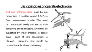 Basicprinciplesofoperativetechnique
• Exit and entrance sites must be pre
determined. It must be located 1.5- 2 cm
from neurovascular bundle. Wire must
be introduced slowly and on the side
containing critical structure. Skin must be
supported by finger pressure to secure
exact point of wire penetration. In
planned distraction skin should be
pushed towards site of corticotomy.
DPS
 