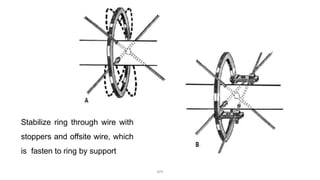 Stabilize ring through wire with
stoppers and offsite wire, which
is fasten to ring by support
DPS
 