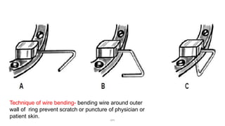 Technique of wire bending- bending wire around outer
wall of ring prevent scratch or puncture of physician or
patient skin.
DPS
 