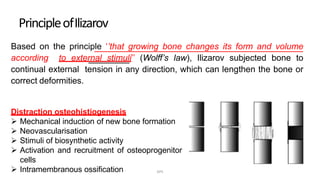 PrincipleofIlizarov
Based on the principle ‘’that growing bone changes its form and volume
according to external stimuli’’ (Wolff’s law), Ilizarov subjected bone to
continual external tension in any direction, which can lengthen the bone or
correct deformities.
Distraction osteohistiogenesis
 Mechanical induction of new bone formation
 Neovascularisation
 Stimuli of biosynthetic activity
 Activation and recruitment of osteoprogenitor
cells
 Intramembranous ossification DPS
 