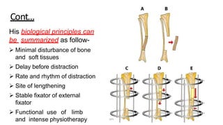 Cont…
His biological principles can
be summarized as follow-
 Minimal disturbance of bone
and soft tissues
 Delay before distraction
 Rate and rhythm of distraction
 Site of lengthening
 Stable fixator of external
fixator
 Functional use of limb
and intense physiotherapy DPS
 