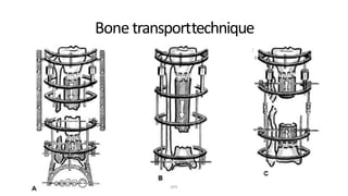 Bone transporttechnique
DPS
 