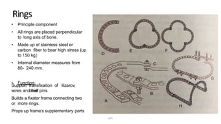 Rings
• Principle component
• All rings are placed perpendicular
to long axis of bone.
• Made up of stainless steel or
carbon fiber to bear high stress (up
to 150 kg)
• Internal diameter measures from
80- 240 mm.
• Function-
Support transfixation of ilizarov,
olivewires and half pins
Builds a fixator frame connecting two
or more rings.
Props up frame’s supplementary parts
DPS
 