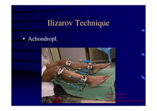 Ilizarov Technique 
• Achondropl. 
Dr Saleh W Alharby 
alharby@ksu.edu..sa 
http:/faculty.ksu.edu.sa/DrSalehAlharby 
 