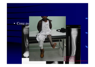 • Cong pseudarth 
Dr Saleh W Alharby 
alharby@ksu.edu..sa 
http:/faculty.ksu.edu.sa/DrSalehAlharby 
 