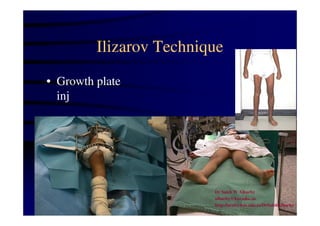 Ilizarov Technique 
• Growth plate 
inj 
Dr Saleh W Alharby 
alharby@ksu.edu..sa 
http:/faculty.ksu.edu.sa/DrSalehAlharby 
 