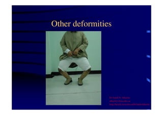 Other deformities 
Dr Saleh W Alharby 
alharby@ksu.edu..sa 
http:/faculty.ksu.edu.sa/DrSalehAlharby 
 