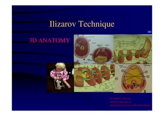 Ilizarov Technique 
3D ANATOMY 
Dr Saleh W Alharby 
alharby@ksu.edu..sa 
http:/faculty.ksu.edu.sa/DrSalehAlharby 
 