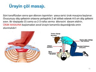 15
Ürəyin çöl masajı.
Süni tənəffüsdən sonra qan dövranı tapıntıları yoxsa xarici ürək masajına başlanar.
Ovucunuzu döş qəfəsinin ortasına yerləşdirib 2 əli istifadı edərək 4-5 sm döş qəfəsini
sıxın. Bir dəqiqədə 15 sıxma və 2-3 nəfəs vermə dövrəsini davam etdirin.
ÜRƏK MASAJINA başlamadan əvvəl ürəyin tamamilə dayandığında əmin
olunmalıdır!
 