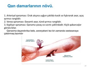 21
Qan damarlarının növü.
1. Arteriyal qanaması: Ürək atışına uyğun şəkildə kəsik və fışkırarak axar, açıq
qırmızı rənglidir.
2. Venoz qanaması: Davamlı axar, tünd qırmızı rənglidir.
3. Kapliyar qanaması: Qanama yavaş və sızıntı şəklindədir. Kiçik qabarcıqlar
görülə bilər.
Qanaxma dayandırılsa belə, zərərçəkəni tez bir zamanda xəstəxanaya
çatdırmaq lazımdır
 