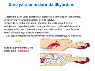 Sinə yaralanmalarında ilkyardım.
30
1-Batan bir cisim varsa çıkartılmaz, dışarı çıkan kemik uçları içeri itilmez.
2-Hava yolu ve solunum kontrol altında tutulur.
3-Göğüste derin bir yara varsa, göğüs boşluğunda negatif basınç
olduğundan dışarıdan içeriye hava girebilir ve akciğerlerin büzüşmesine
sebep olabilir, bunu önlemek için yaranın üstü temiz bir naylonla, ıslak
temiz bir bezle veya elimizle kapatılmalıdır.
* Acil Sağlık Personeline haber vermeli ve uygun hastaneye nakledilmeli.
DİQQIT
Bütün açiq yaralanmalarda
batan cisim cıxarılmaz
 