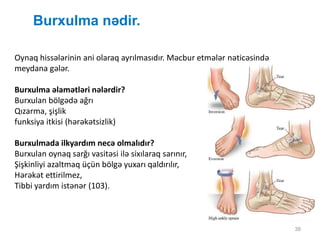 Burxulma nədir.
38
Oynaq hissələrinin ani olaraq ayrılmasıdır. Məcbur etmələr nəticəsində
meydana gələr.
Burxulma əlamətləri nələrdir?
Burxulan bölgədə ağrı
Qızarma, şişlik
funksiya itkisi (hərəkətsizlik)
Burxulmada ilkyardım necə olmalıdır?
Burxulan oynaq sarğı vasitəsi ilə sixılaraq sarınır,
Şişkinliyi azaltmaq üçün bölgə yuxarı qaldırılır,
Hərəkət ettirilmez,
Tibbi yardım istənər (103).
 
