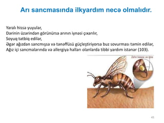 Arı sancmasında ilkyardım necə olmalıdır.
45
Yaralı hissə yuyular,
Dərinin üzərindən görünürsə arının iynəsi çıxarılır,
Soyuq tətbiq edilər,
Əgər ağızdan sancmışsa və tənəffüsü güçleştiriyorsa buz sovurması təmin edilər,
Ağız içi sancmalarında və allergiya halları olanlarda tibbi yardım istənər (103).
 