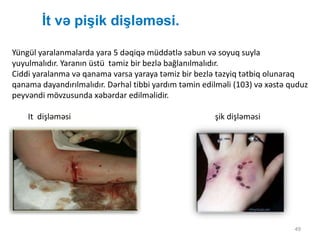 İt və pişik dişləməsi.
49
Yüngül yaralanmalarda yara 5 dəqiqə müddətlə sabun və soyuq suyla
yuyulmalıdır. Yaranın üstü təmiz bir bezlə bağlanılmalıdır.
Ciddi yaralanma və qanama varsa yaraya təmiz bir bezlə təzyiq tətbiq olunaraq
qanama dayandırılmalıdır. Dərhal tibbi yardım təmin edilməli (103) və xəstə quduz
peyvəndi mövzusunda xəbərdar edilməlidir.
It dişləməsi şik dişləməsi
 