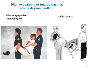 Əllər və ayaqlardan tutaraq daşıma,
stolda daşıma üsulları.
57
Əllər və ayaqlardan
tutaraq daşıma
Stolda daşıma
 