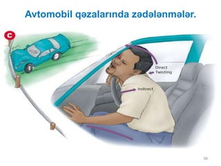 Avtomobil qəzalarında zədələnmələr.
58
 