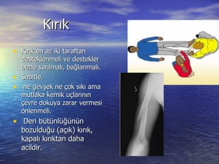 Kırık Kırık en az iki taraftan desteklenmeli ve destekler bezle sarılmalı, bağlanmalı. Sabitle, ne gevşek ne çok sıkı ama mutlaka kemik uçlarının çevre dokuya zarar vermesi önlenmeli. Deri bütünlüğünün bozulduğu (açık) kırık, kapalı kırıktan daha acildir. 