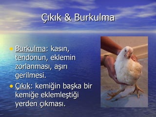 Çıkık & Burkulma Burkulma : kasın, tendonun, eklemin zorlanması, aşırı gerilmesi. Çıkık : kemiğin başka bir kemiğe eklemleştiği yerden çıkması. 