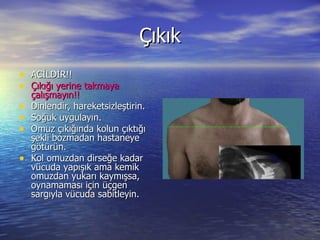 Çıkık ACİLDİR!! Çıkığı yerine takmaya çalışmayın!!  Dinlendir, hareketsizleştirin. Soğuk uygulayın. Omuz çıkığında kolun çıktığı şekli bozmadan hastaneye götürün.  Kol omuzdan dirseğe kadar vücuda yapışık ama kemik omuzdan yukarı kaymışsa, oynamaması için üçgen sargıyla vücuda sabitleyin. 