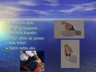 Hava yolu açık. Bir el ile hastanın burnunu kapatın. Diğer eliniz ile çeneyi açık tutun. Derin nefes alın. 