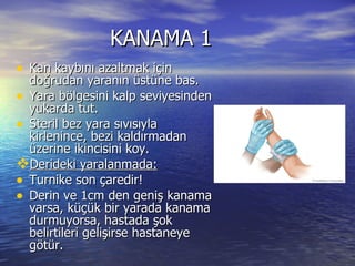KANAMA 1  Kan kaybını azaltmak için doğrudan yaranın üstüne bas. Yara bölgesini kalp seviyesinden yukarda tut. Steril bez yara sıvısıyla kirlenince, bezi kaldırmadan üzerine ikincisini koy. Derideki yaralanmada: Turnike son çaredir! Derin ve 1cm den geniş kanama varsa, küçük bir yarada kanama durmuyorsa, hastada şok belirtileri gelişirse hastaneye götür. 