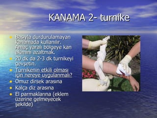 KANAMA 2- turnike Basıyla durdurulamayan kanamada kullanılır. Amaç yaralı bölgeye kan akımını azaltmak. 20 dk da 2-3 dk turnikeyi gevşetin. Turnikenin etkili olması için nereye uygulanmalı? Omuz dirsek arasına Kalça diz arasına El parmaklarına (eklem üzerine gelmeyecek şekilde) 