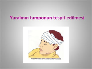 Yaralının tamponun tespit edilmesi 
