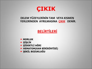 ÇIKIK EKLEM YÜZEYLERİNİN TAM  VEYA KISMEN  YERLERİNDEN  AYRILMASINA  ÇIKIK   DENİR. BELİRTİLERİ   MORLUK ŞİŞLİK ŞİDDETLİ AĞRI HEMATOM(KAN BİRİKİNTİSİ)  ŞEKİL BOZUKLUĞU 