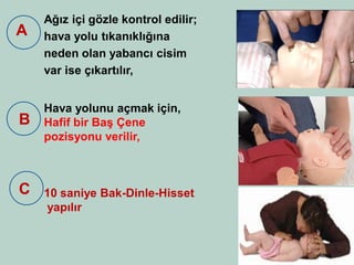 Ağız içi gözle kontrol edilir; 
hava yolu tıkanıklığına 
neden olan yabancı cisim 
var ise çıkartılır, 
Hava yolunu açmak için, 
Hafif bir Baş Çene 
pozisyonu verilir, 
10 saniye Bak-Dinle-Hisset 
yapılır 
A 
B 
C  
